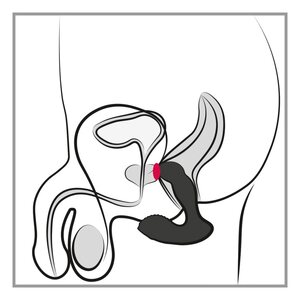 Rebel Radio-Controlled Prostate Massager
