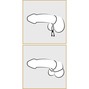 Bad Kitty Cock & Ball Loop, kiristettävä penisrengas